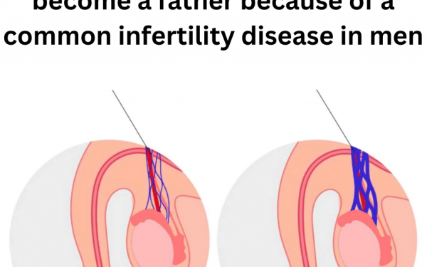 Almost lost the opportunity to become a father because of a common infertility disease in men