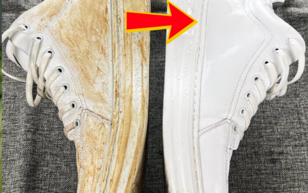 White shoes are yellowed