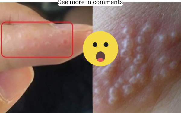 Many people still think this is a normal itching disease, just let it heal on its own without knowing the cause behind it.